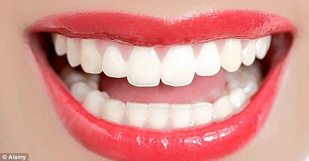 hollywood smiles teeth whitening kit reviews