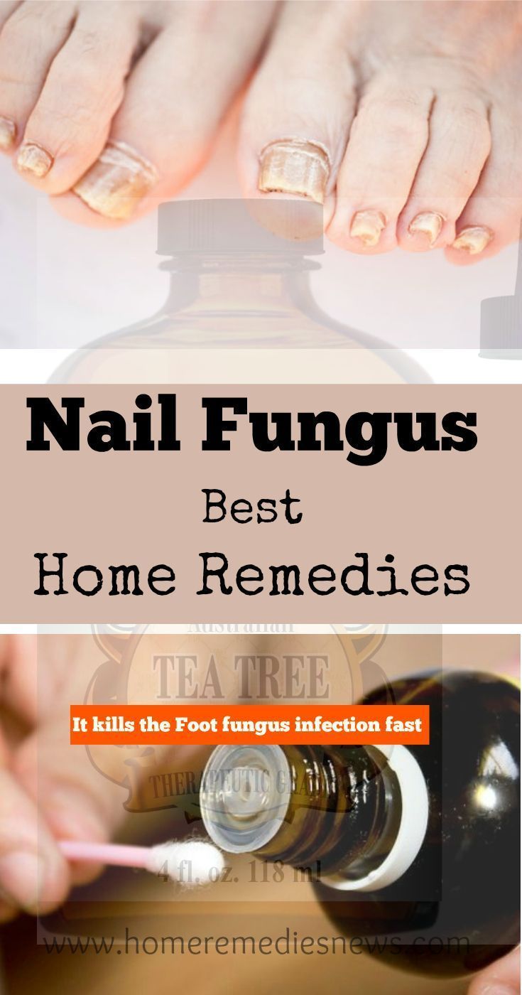 best toenail fungus treatment reviews